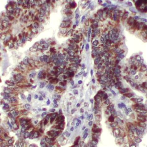 Braf V600e Rm8 Pathnsitu Biotechnologies