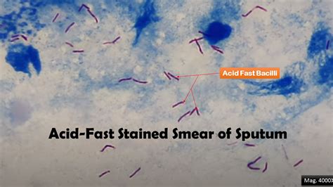 Acid Fast Stain Introduction Principle Procedure Result Interpretation