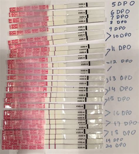 Line progression: Wondfo / DPO 5-20. HCG beta was 299 at 16DPO and 764