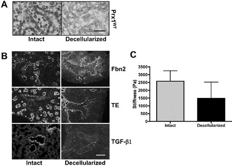 Fetal Lung Extracellular Matrix Ecm Is Well Preserved After