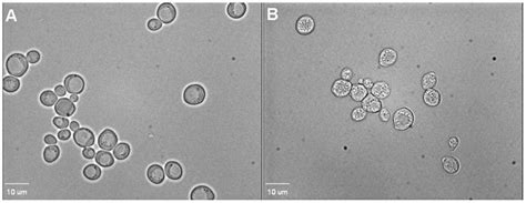 Phase Contrast Microscope Images Of FG08 Effects On The Cell Internal