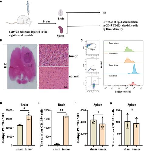 Frontiers Glioblastoma Derived Exosomes Promote Lipid Accumulation