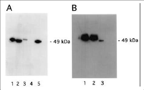 Detection Of Flag Bap Proteins By Western Blot A Western Blot Of