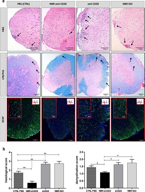 Eae Spinal Cord Pathology A Panels Show Representative Images For