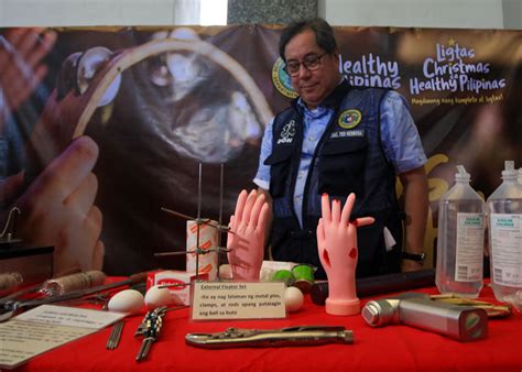 DOH Firecracker Injuries Climb To 107 Manila Standard