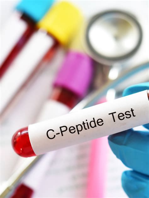 Are You Making Any Insulin? A C-Peptide Test Can Give You The Answer ...