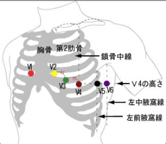 12誘導心電図とは？手順や装着部位・貼り方、検査の目的などを解説 | ナースのヒント