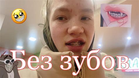 Без Зубов | Брекеты - YouTube