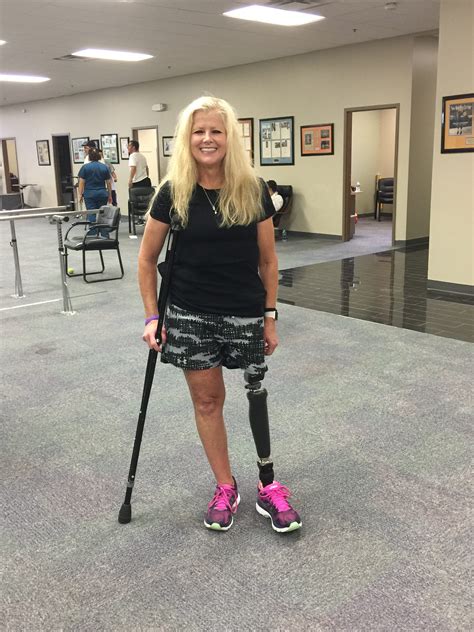 Double Amputee Prosthetic Legs