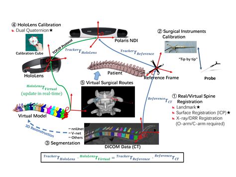 AR-based Surgical Navigation