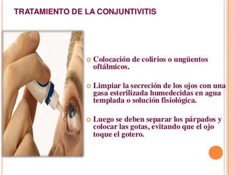 Conjuntivitis