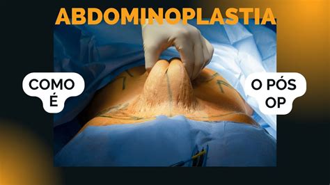 Como O P S Operat Rio Da Abdominoplastia Youtube