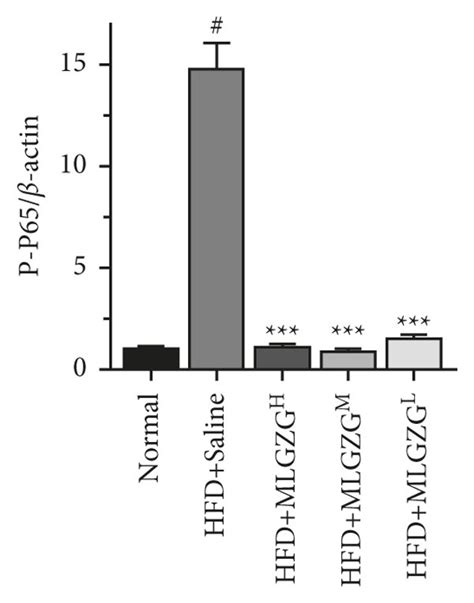 MLGZG inhibits the TLR 4 TRAF 3 NF κB pathway in NASH livers a