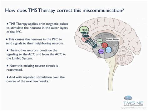 How Does Tms Therapy Work Youtube