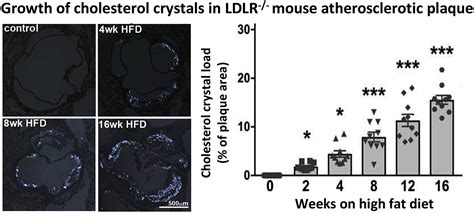 Ultramorphological Analysis Of Plaque Advancement And Cholesterol