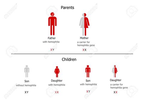 What Is Haemophilia Write Its Sex Linked Inheritance Pattern