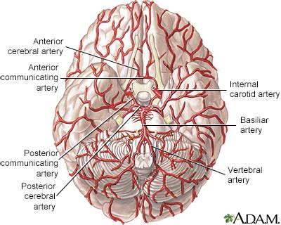 Cerebral Amyloid Angiopathy Symptoms, Doctors, Treatments, Advances ...