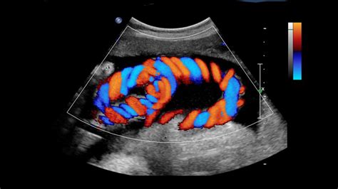 Diagnostic Centre In Thane Color Doppler Ultrasound X Ray