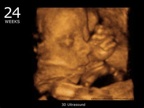 30 weeks pregnant 3d ultrasound - ucmumu