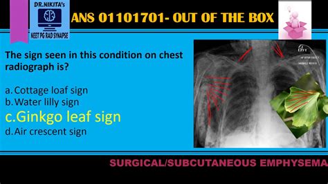 Subcutaneous Emphysema Cxr Gingko Leaf Sign Youtube