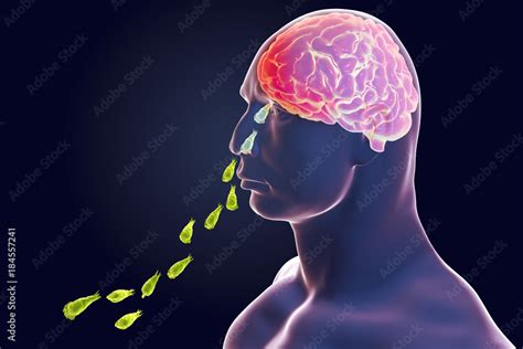 Brain Eating Amoeba Infection Naegleriasis Nasal Passage Of Naegleria