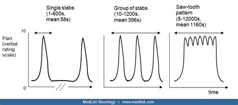 SUNCT syndrome | MedLink Neurology