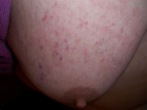 Electrical Tape Breast Binding Porn Pictures Xxx Photos Sex Images Pictoa