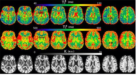 Figure From Estimating Axon Radius Using Diffusion Relaxation Mri