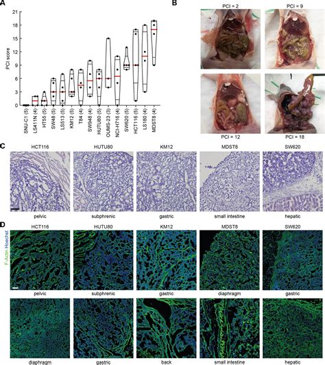 A Mouse Model For Peritoneal Metastases Of Colorectal Origin