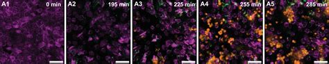 Figures And Data In Dynamic Persistence Of UPEC Intracellular Bacterial