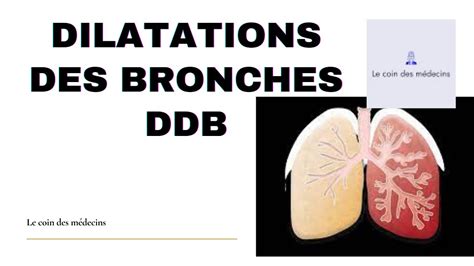 Dilatations Des Bronches Ddb Youtube