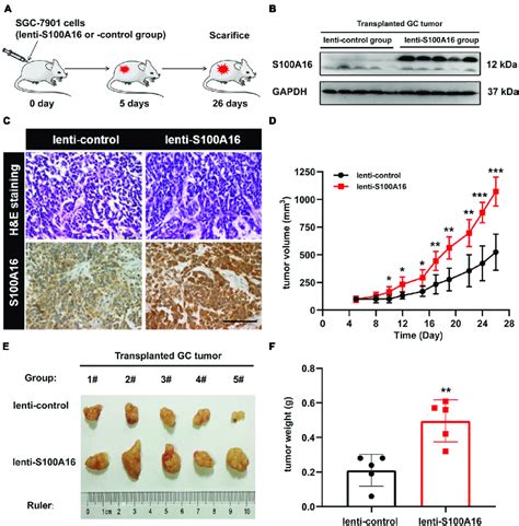 Overexpression Of S100A16 Enhances GC Cells Tumorigenesis In Vivo