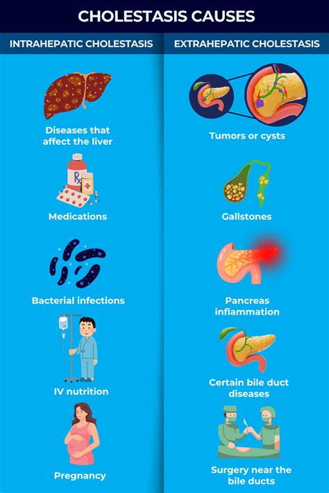 cholestasis   risk factors liver disease news
