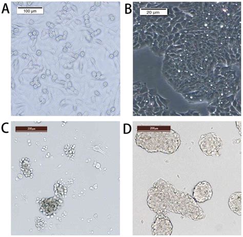 Cancer Cells Vs Normal Cells Microscope