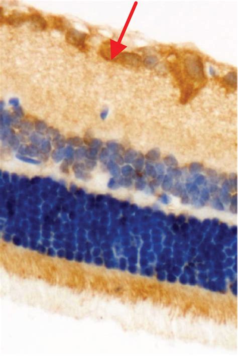 The immunohistochemical staining of HIF 1α and iNOS in retina of OLETF