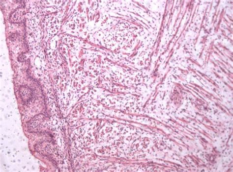 Photomicrograph Showing The Stratified Squamous Epithelium Of The