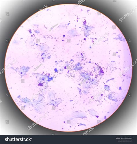 Gram Stain Arcanobacterium Haemolyticum Colony Showing Stock Photo ...