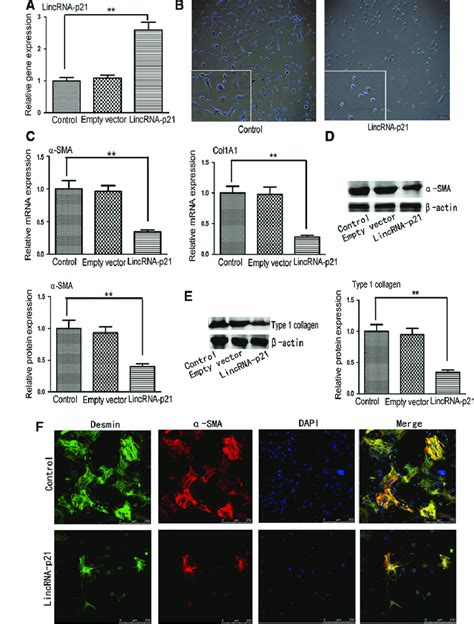 Lincrna P21 Inhibits Hsc Activation A Quantitative Real Time Pcr Download Scientific Diagram