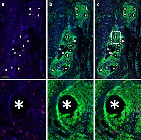 Immunofluorescence Labeling Of Macrophages Cd68 And Mmp 8 A Labeling Download Scientific