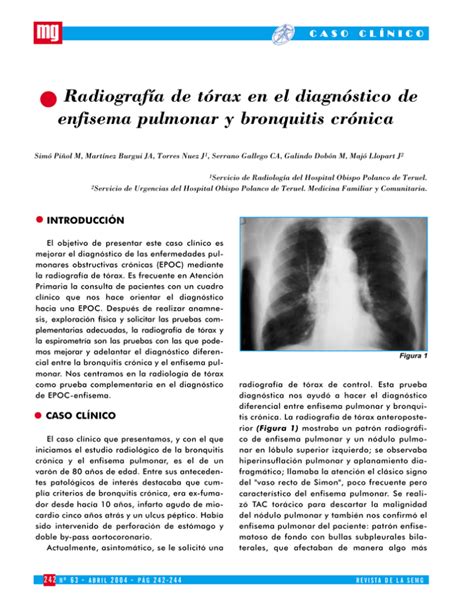 Radiograf A De T Rax En El Diagn Stico De Enfisema Pulmonar Y