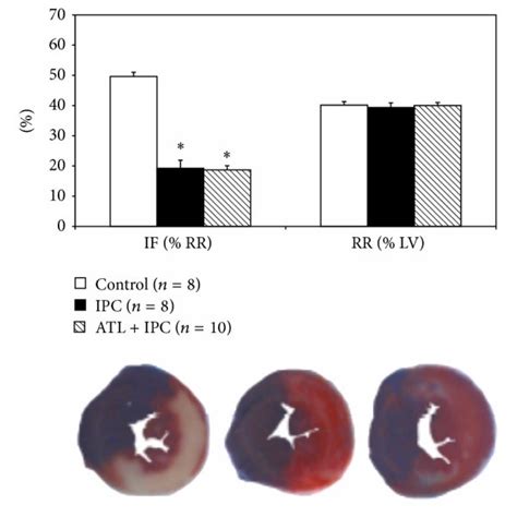 Role Of A Br Antagonist In Ischemic Preconditioning Pretreating Mice