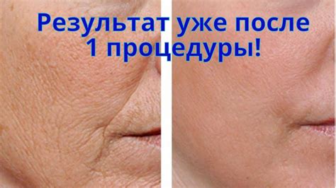 Антивозрастная маска для лица. Простой рецепт, результату после 1 ...