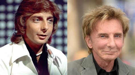 Barry Manilow S Plastic Surgery The Mandy Singer Has Denied Getting