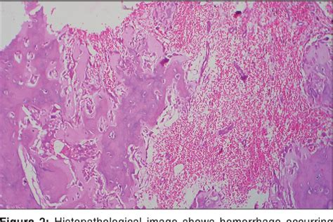 A Review Of Artifacts In Histopathology Semantic Scholar