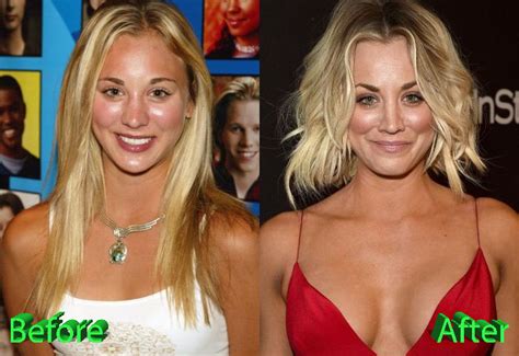 Kaley Cuoco Before After