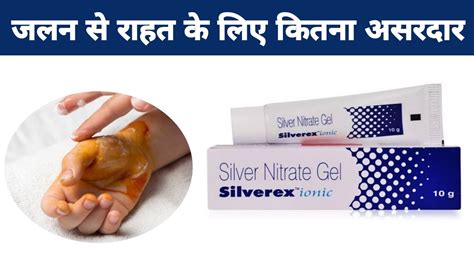 Uses Of Silverex Ionic Wound Healing Gel With Silver Nitrate 0 2