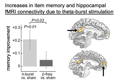 Theta Burst Stimulation — Hermiller Lab