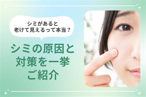 シミがあると老けて見えるって本当？シミの原因と対策を一挙ご紹介 梅田すずらんクリニックブログ