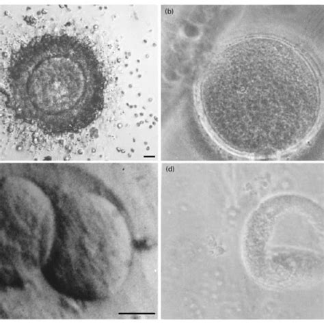 Development Of Immature Human Oocytes After Ultrarapid Download Scientific Diagram