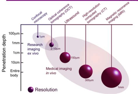 Definition of Optical Coherence Tomography (OCT) Flashcards | Quizlet